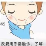 面部吸脂多少钱一个部位？吸脂有风险吗？科普讲解