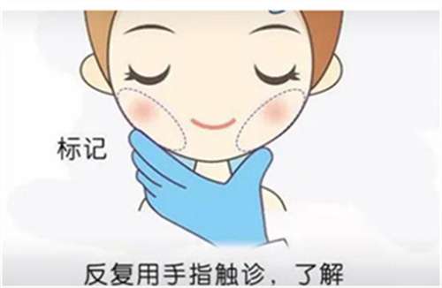 面部吸脂多少钱一个部位？吸脂有风险吗？科普讲解