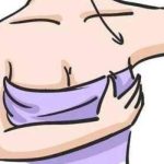 重庆军美脂肪填充丰胸如何？医院资质、收费等分享