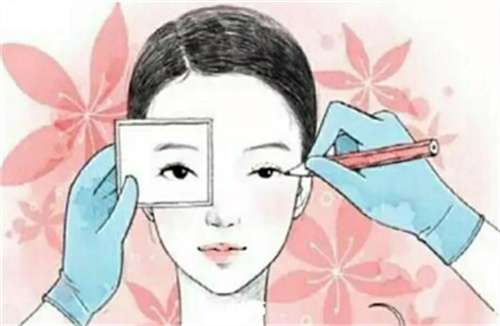 全切双眼皮多少钱啊?价格表分析，看详情