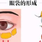 上海去眼袋手术费用大概多少钱