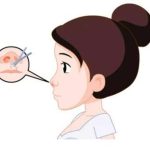 吉林肋骨隆鼻价格贵不贵？客观揭秘自认隆鼻术式的价格