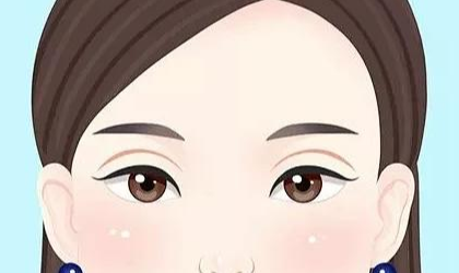 遵义双眼皮修复案例分享！术后宽改窄+肉条修复
