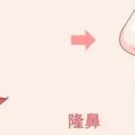北京做肋骨鼻部综合多少钱？在24313元至76531元之间