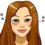 威海祛眼袋多少钱?详细了解威海地区祛眼袋医院