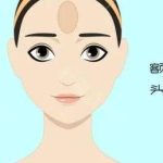 沈阳玻尿酸丰额头要多少钱