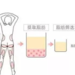 哈尔滨医大一院打水光针多少钱？1000元起，本土热门医院与真假辨别指南