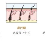 广州做全身脱毛到底要花多少钱？