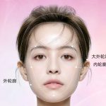 广州做馒化脸修复哪位医生技术稳？避坑指南在此