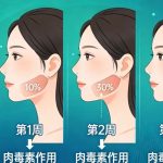 长沙打瘦脸针哪个医生技术好？本地人真实推荐