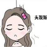头顶加密一般多少钱？同步价格表，2026年