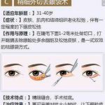 山东做手术去眼袋要花多少钱？价格参考是3000到800元不等