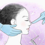 玻尿酸隆鼻多少钱一支