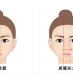 整容鼻翼缩小多少钱？手法风险大不大？2026年价格