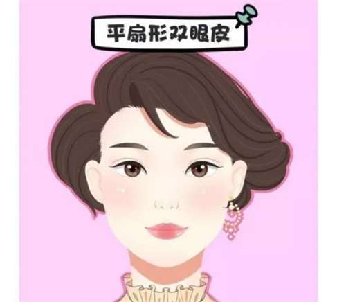 广州全切双眼皮多少钱？价格对比与手术注意事项揭秘