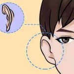 上海艺星整形医院做一只招风耳手术费用高吗？院内坐诊医生及案例分享