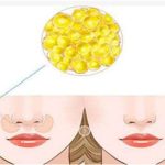 面部脂肪填充多少钱左右？价格更新了，速围观