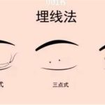 埋线双眼皮比全切双眼皮便宜吗？价格不高还不开刀