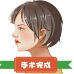 北京隆鼻价格是多少？看全新价格公布，2026年