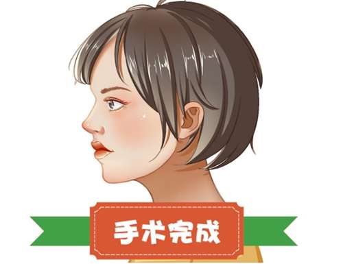 上海隆鼻价格一览表，在线查看2026价格详情