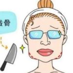 长沙磨骨手术价格？一并了解四名口碑医生
