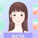 骨性凸嘴矫正手术多少钱？大概需要6500元到24800元