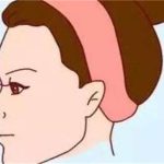 硅胶隆鼻多少钱？硅胶隆鼻多久能恢复？点击了解