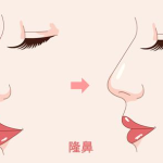 泰州玻尿酸隆鼻要多少钱