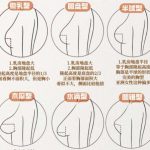 汪灏医生擅长领域介绍！技术口碑分析！整形必看