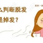 北京头顶稀疏加密价格贵不贵？新价格表公布，看细节