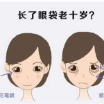 北京去眼袋价格？费用明细与手术选择全面解析