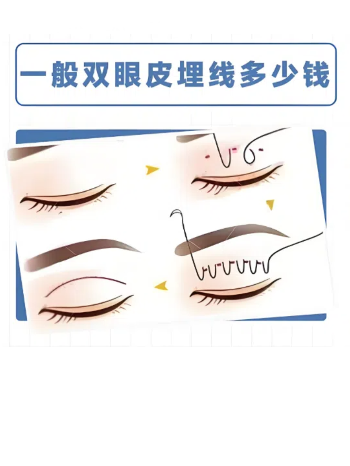 北京眼修复价格多少钱？北京专业眼科医院眼修复手术费用明细