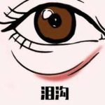 重庆泪沟填充玻尿酸多少钱