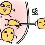 长春腿部抽脂需要多少钱？剖析塑形美腿手术的经济评估