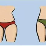 腰腹部吸脂一般多少钱？多见看到效果？在线解答