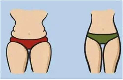 腰腹部吸脂一般多少钱？多见看到效果？在线解答