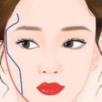 宽颧骨磨骨整形多少钱？手术有风险吗？术后多久恢复