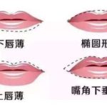 大连市嘟嘟唇玻尿酸多少钱