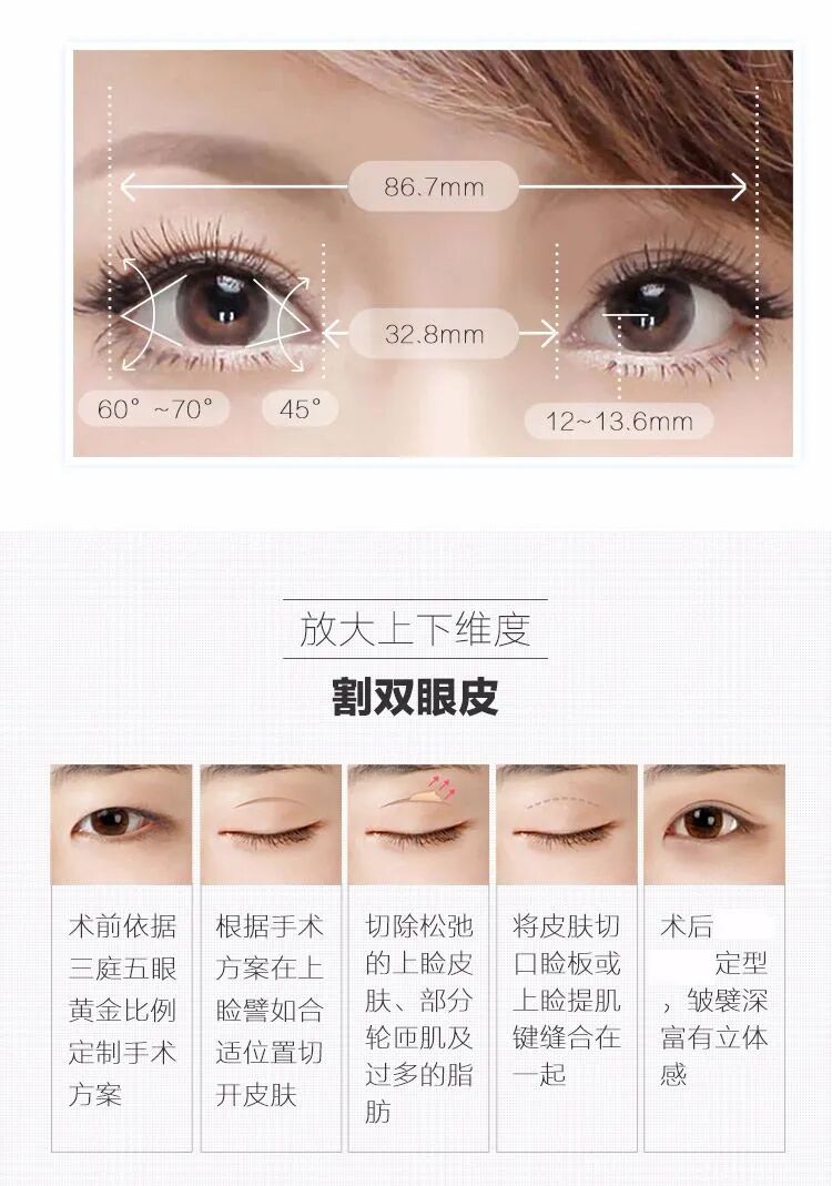 武汉双眼皮术前设计怎么做？就看这五点做