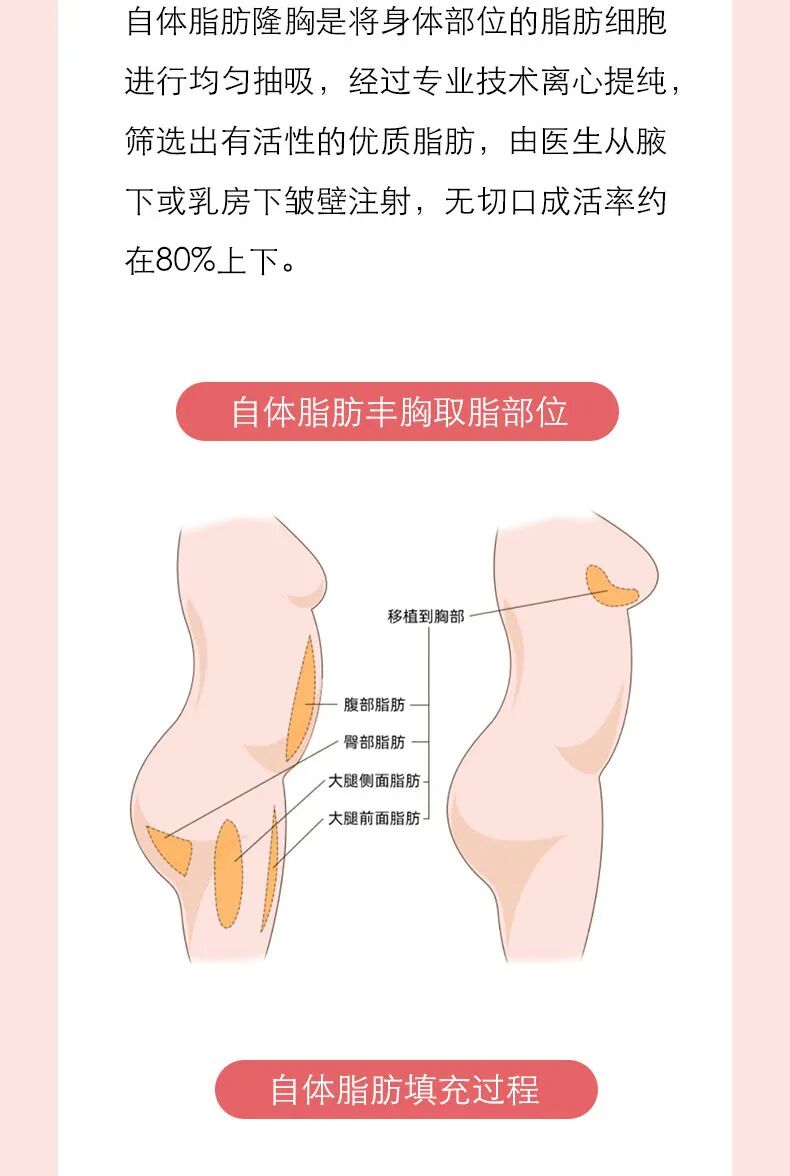 自体脂肪隆胸后出现硬块怎么办？自体脂肪隆胸后会不会有淤血？