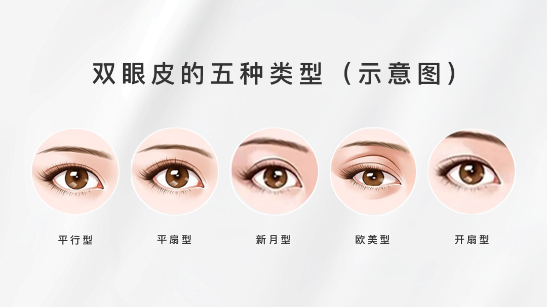 什么类型双眼皮好看？