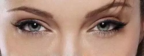 欧式双眼皮和三点双眼皮哪个更符合大众审美？